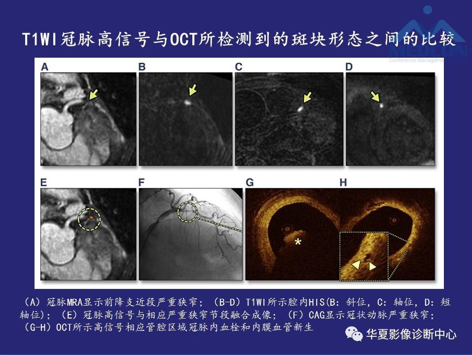 肌瘦消红玉